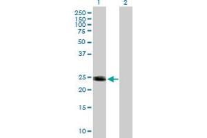 Western Blot analysis of HRAS expression in transfected 293T cell line by HRAS MaxPab polyclonal antibody.