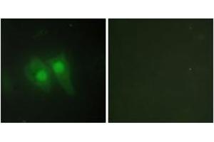 Immunofluorescence analysis of HeLa cells, using STEA3 Antibody. (STEAP3 antibody  (AA 421-470))