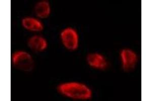ABIN6275864 staining HepG2 by IF/ICC. (ERI1 antibody  (C-Term))