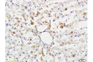 Formalin-fixed and paraffin embedded rat brain tissue labeled with Anti-ABHD5 Polyclonal Antibody, Unconjugated (ABIN708596) at 1:200 followed by conjugation to the secondary antibody and DAB staining (ABHD5 antibody  (AA 281-349))