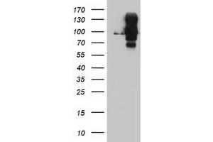 HEK293T cells were transfected with the pCMV6-ENTRY control (Left lane) or pCMV6-ENTRY DPP9 (Right lane) cDNA for 48 hrs and lysed. (DPP9 antibody)
