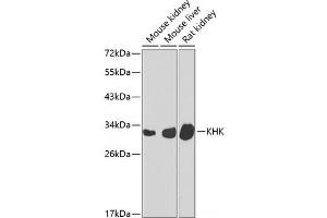 Western blot analysis of extracts of various cell lines using KHK Polyclonal Antibody at dilution of 1:1000. (Ketohexokinase antibody)