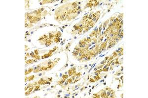 Immunohistochemistry of paraffin-embedded Human gastric using ATP6AP1 antibody at dilution of 1:100 (x400 lens).