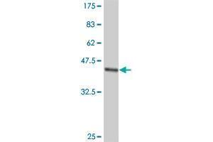 Western Blot detection against Immunogen (38. (PTPLAD1 antibody  (AA 1-113))