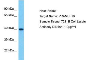 Host: Rabbit Target Name: PRAMEF19 Sample Type: 721_B Whole Cell lysates Antibody Dilution: 1. (PRAMEF19 antibody  (N-Term))