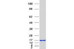 Western Blotting (WB) image for Eukaryotic Translation Initiation Factor 4E Binding Protein 2 (EIF4EBP2) protein (Myc-DYKDDDDK Tag) (ABIN2714236)