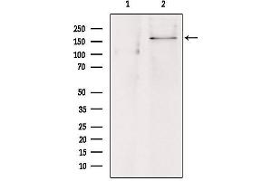 Western blot analysis of extracts from hepg2, using ABCC8 Antibody.
