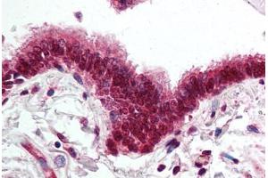 Human Lung, Respiratory Epithelium (formalin-fixed, paraffin-embedded) stained with SKIL antibody ABIN295508 at 5 ug/ml followed by biotinylated goat anti-rabbit IgG secondary antibody ABIN481713, alkaline phosphatase-streptavidin and chromogen. (SKIL antibody  (AA 600-684))