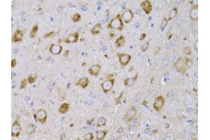 Immunohistochemistry of paraffin-embedded rat brain using NGF antibody (ABIN6293296) at dilution of 1:75 (40x lens). (Nerve Growth Factor antibody)