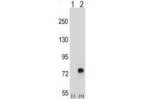 Western blot analysis of TGFBI antibody and 293 cell lysate either nontransfected (Lane 1) or transiently transfected (2) with the TGFBI gene. (TGFBI antibody  (AA 106-135))