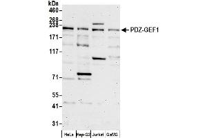 Western Blotting (WB) image for anti-Rap Guanine Nucleotide Exchange Factor (GEF) 2 (RAPGEF2) (AA 975-1025) antibody (ABIN7453596)