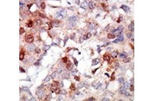 Immunohistochemistry (IHC) image for anti-V-Akt Murine Thymoma Viral Oncogene Homolog 3 (Protein Kinase B, Gamma) (AKT3) (AA 88-118) antibody (ABIN3029482)