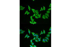 Immunofluorescence analysis of U2OS cells using MLN antibody (ABIN5973790). (Motilin antibody)