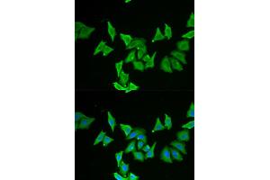 Immunofluorescence analysis of U2OS cells using MLN antibody (ABIN5973790). (Motilin antibody)
