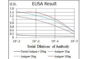 Black line: Control Antigen (100 ng), Purple line: Antigen(10 ng), Blue line: Antigen (50 ng), Red line: Antigen (100 ng), (Cardiac Troponin T2 antibody)