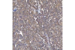 IHC analysis of ACAD9 using anti-ACAD9 antibody (ABIN7602670). (ACAD9 antibody  (AA 92-621))