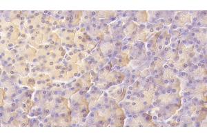 Detection of LIF in Human Pancreas Tissue using Monoclonal Antibody to Leukemia Inhibitory Factor (LIF) (LIF antibody  (AA 2-201))