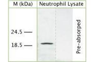 WB on human neutrophil lysate using Sheep antibody to human Cathelicidin antimicrobial peptide (CAP-18, hCAP-18, antibacterial protein LL-37, CAMP, CRAMP, FALL39): IgG (ABIN350187) at 50 µg/ml concentration. (Cathelicidin antibody)