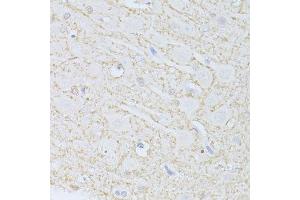 Immunohistochemistry (Paraffin-embedded Sections) (IHC (p)) image for anti-phosphoglycerate Dehydrogenase (PHGDH) (AA 264-533) antibody (ABIN6145554)