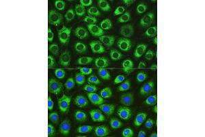 Immunofluorescence analysis of L929 cells using DN Rabbit pAb (ABIN6130306, ABIN6139717, ABIN6139719 and ABIN6215728) at dilution of 1:100.