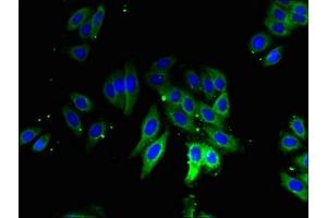 Immunofluorescent analysis of HepG2 cells using ABIN7142723 at dilution of 1:100 and Alexa Fluor 488-congugated AffiniPure Goat Anti-Rabbit IgG(H+L) (RPLP1 antibody  (AA 2-114))