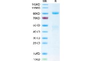 SDS-PAGE (SDS) image for Met Proto-Oncogene (MET) (AA 25-932) protein (His-Avi Tag,Biotin) (ABIN7275249)