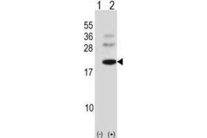 Western Blotting (WB) image for anti-BARX Homeobox 1 (BARX1) antibody (ABIN2998377)