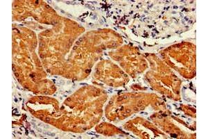 Immunohistochemistry of paraffin-embedded human kidney tissue using ABIN7144627 at dilution of 1:100 (DDC antibody  (AA 24-215))