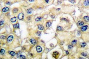 Image no. 1 for anti-Fibroblast Growth Factor Receptor 2 (FGFR2) antibody (ABIN265417) (FGFR2 antibody)