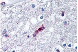 Human Brain, Oligodendrocytes (formalin-fixed, paraffin-embedded) stained with MBP antibody ABIN307190 at 5 ug/ml followed by biotinylated anti-mouse IgG secondary antibody ABIN481714, alkaline phosphatase-streptavidin and chromogen. (MBP antibody  (AA 130-136))