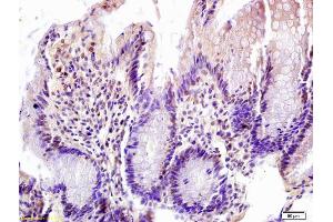 Formalin-fixed and paraffin embedded rat colon labeled with Anti-FOXN1 Polyclonal Antibody, Unconjugated (ABIN1387592) at 1:200 followed by conjugation to the secondary antibody and DAB staining (FOXN1 antibody  (AA 321-420))