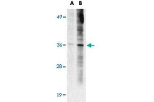 Western blot analysis of ST3GAL6 in HeLa cell lysate with ST3GAL6 polyclonal antibody  at (A) 1 and (B) 2 ug/mL . (ST3GAL6 antibody  (C-Term))