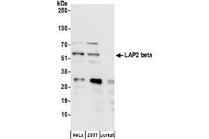 Western Blotting (WB) image for anti-LAP2 beta gamma/tmpo (AA 404-454) antibody (ABIN7453457) (LAP2 beta gamma/tmpo (AA 404-454) antibody)