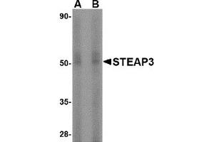 Western Blotting (WB) image for anti-STEAP Family Member 3, Metalloreductase (STEAP3) (N-Term) antibody (ABIN1031588) (STEAP3 antibody  (N-Term))