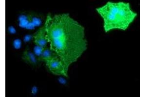 Anti-BIN3 mouse monoclonal antibody (ABIN2454016) immunofluorescent staining of COS7 cells transiently transfected by pCMV6-ENTRY BIN3 (RC203378). (BIN3 antibody)