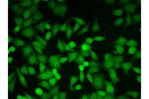 Immunofluorescent staining of HeLa cells with Glo1 monoclonal antibody, clone 6F10 .