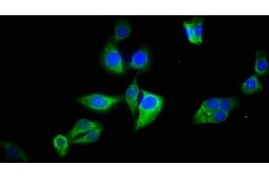 Immunofluorescence staining of HepG2 cells with ABIN7145113 at 1:133, counter-stained with DAPI. (ATG2B antibody  (AA 1357-1536))
