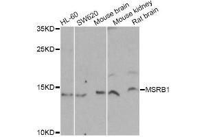 Western blot analysis of extracts of various cell lines, using MSRB1 Antibody (ABIN2559877) at 1:1000 dilution.