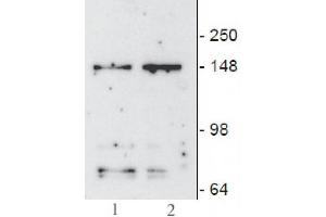 JMJD3/ KDM6B mAb (Clone 67-A2) tested by Western blot.