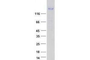 Corin Protein (Myc-DYKDDDDK Tag)