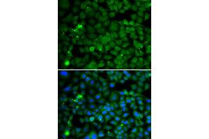 Immunofluorescence analysis of MCF7 cell using SMYD4 antibody. (SMYD4 antibody)