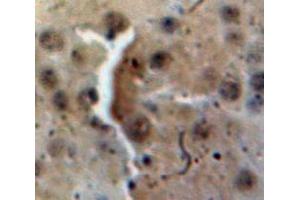 Used in DAB staining on fromalin fixed paraffin-embedded Brain tissue (FKBP3 antibody  (AA 2-224))