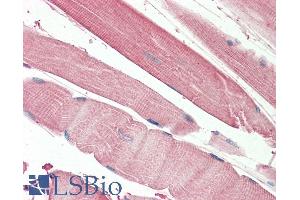ABIN5539899 (5µg/ml) staining of paraffin embedded Human Skeletal Muscle. (THNSL2 antibody  (AA 192-204))
