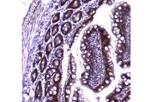 IHC testing of FFPE rat small intestine tissue with Glutathione Reductase antibody at 1ug/ml. (Glutathione Reductase antibody)