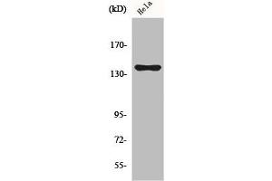 Western Blot analysis of COLO205 cells using KIF4A Polyclonal Antibody (KIF4A antibody  (C-Term))