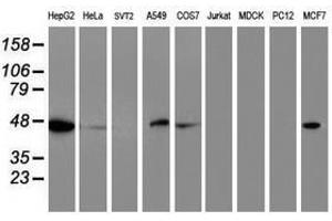 Image no. 2 for anti-Adipocyte Plasma Membrane Associated Protein (APMAP) antibody (ABIN1496665) (APMAP antibody)