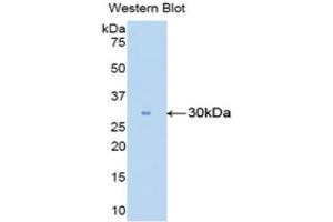 Western Blotting (WB) image for anti-Carbonic Anhydrase II (CA2) (AA 5-258) antibody (ABIN1858211) (CA2 antibody  (AA 5-258))