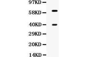 Western blot analysis of TPP1 expression in HELA whole cell lysates (lane 1). (TPP1 antibody  (Middle Region))