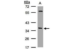 WB Image Sample(30 ug whole cell lysate) A:Hep G2 , 10% SDS PAGE antibody diluted at 1:1000 (NAPA antibody  (Center))