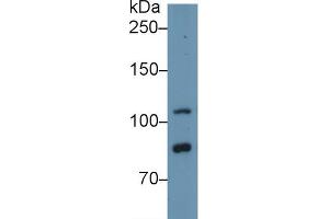 Western Blot; Sample: Human Hela cell lysate; Primary Ab: 1µg/ml Rabbit Anti-Human TLR5 Antibody Second Ab: 0. (TLR5 antibody  (AA 693-858))